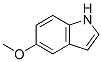 19-Nor-17α-pregn-4-en-20-yn-3-one, 17-hydroxy-2-methylene- (7CI,8CI)